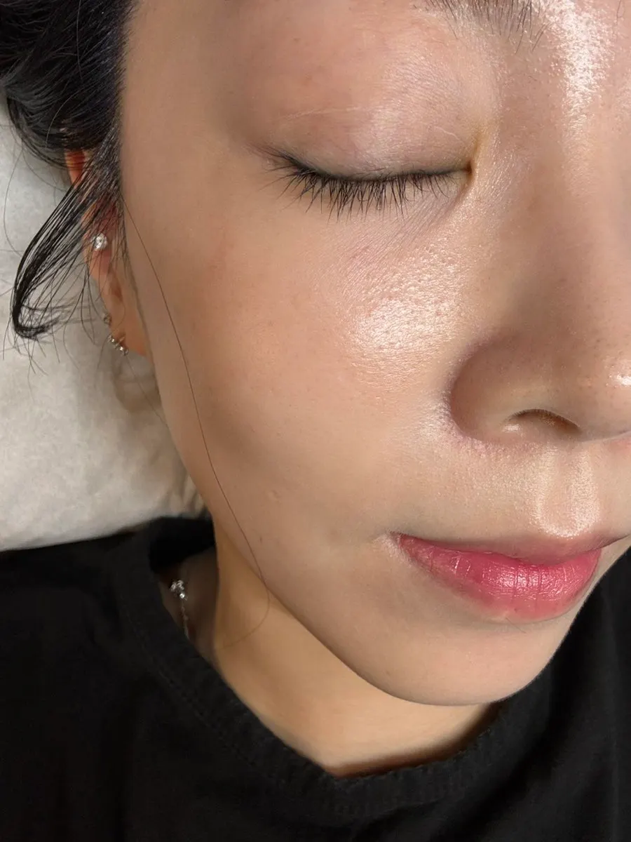 Eyes before the Munjeong Station LED lash extension treatment