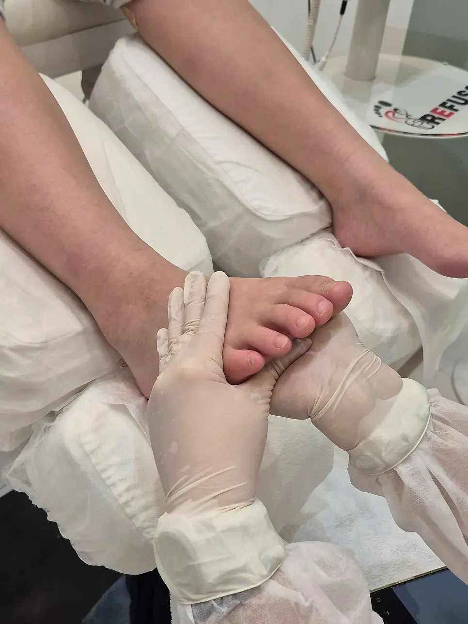 The boy's big toenail before treatment began