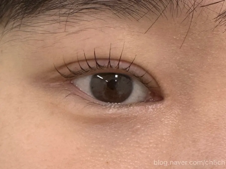 Eye area after keratin ampoule perm with round curl