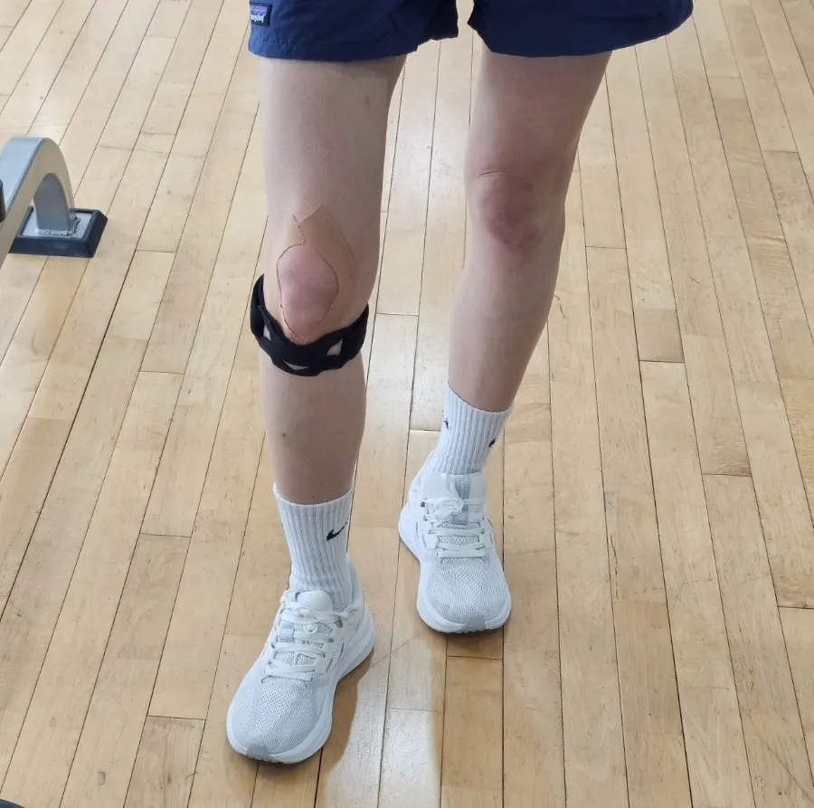 Patellar knee brace used for treadmill running
