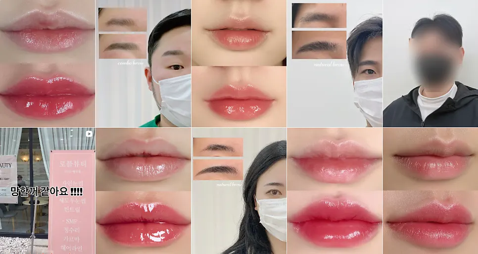 로블뷰티 시술 종류 안내