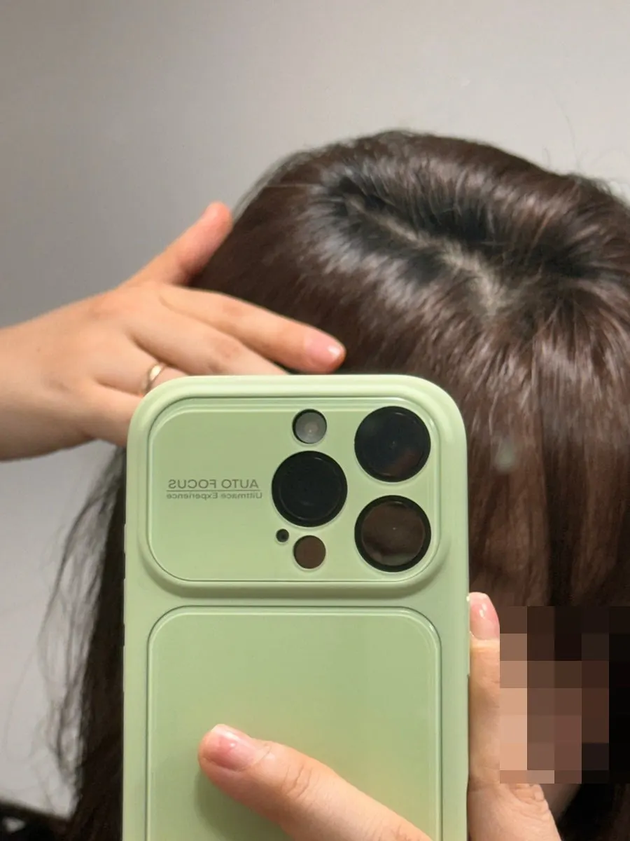 염색 전 뿌리 부분이 드러난 뒷머리