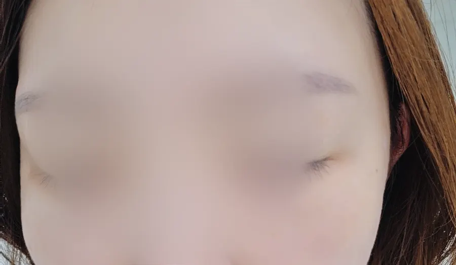 Before shot of lash condition prior to treatment