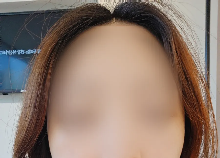 Before-and-after comparison of eyes after extensions