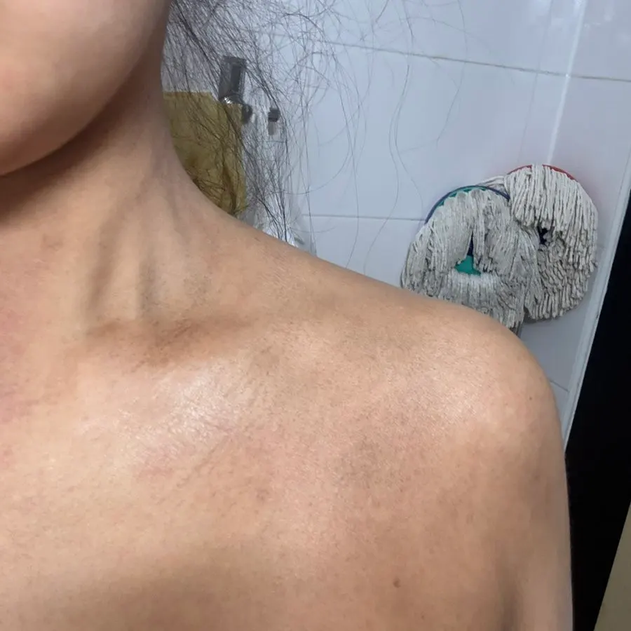 Before-and-after skin tone-up comparison
