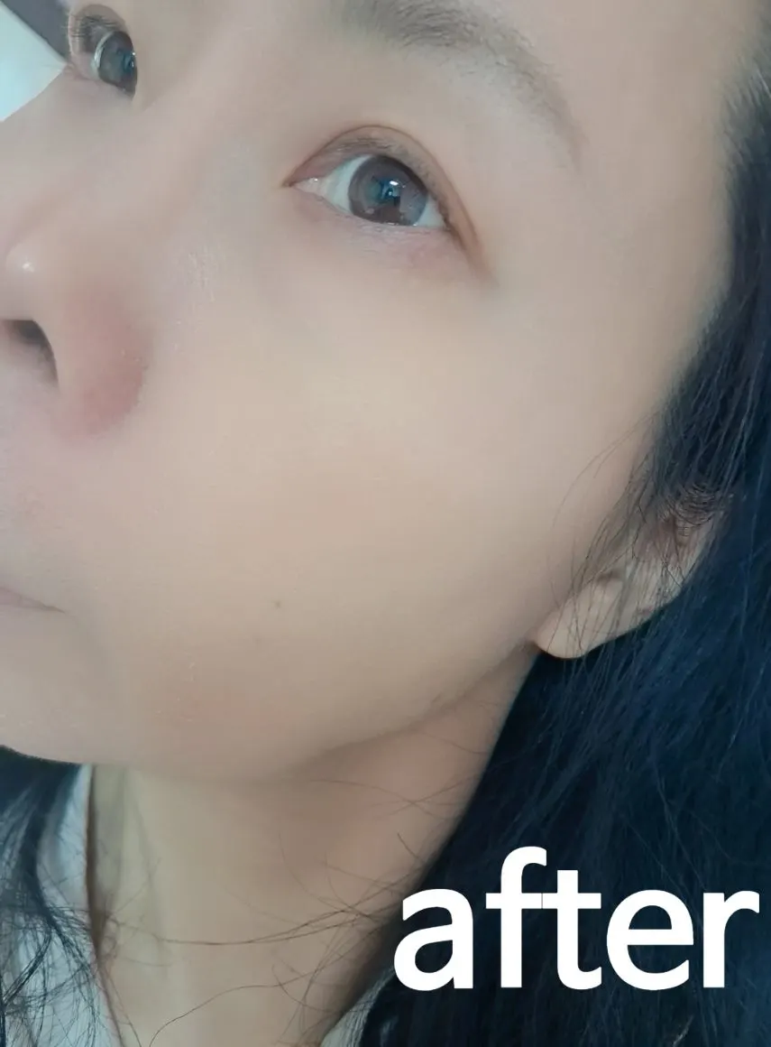메디픽미 마스크팩 마무리 이미지