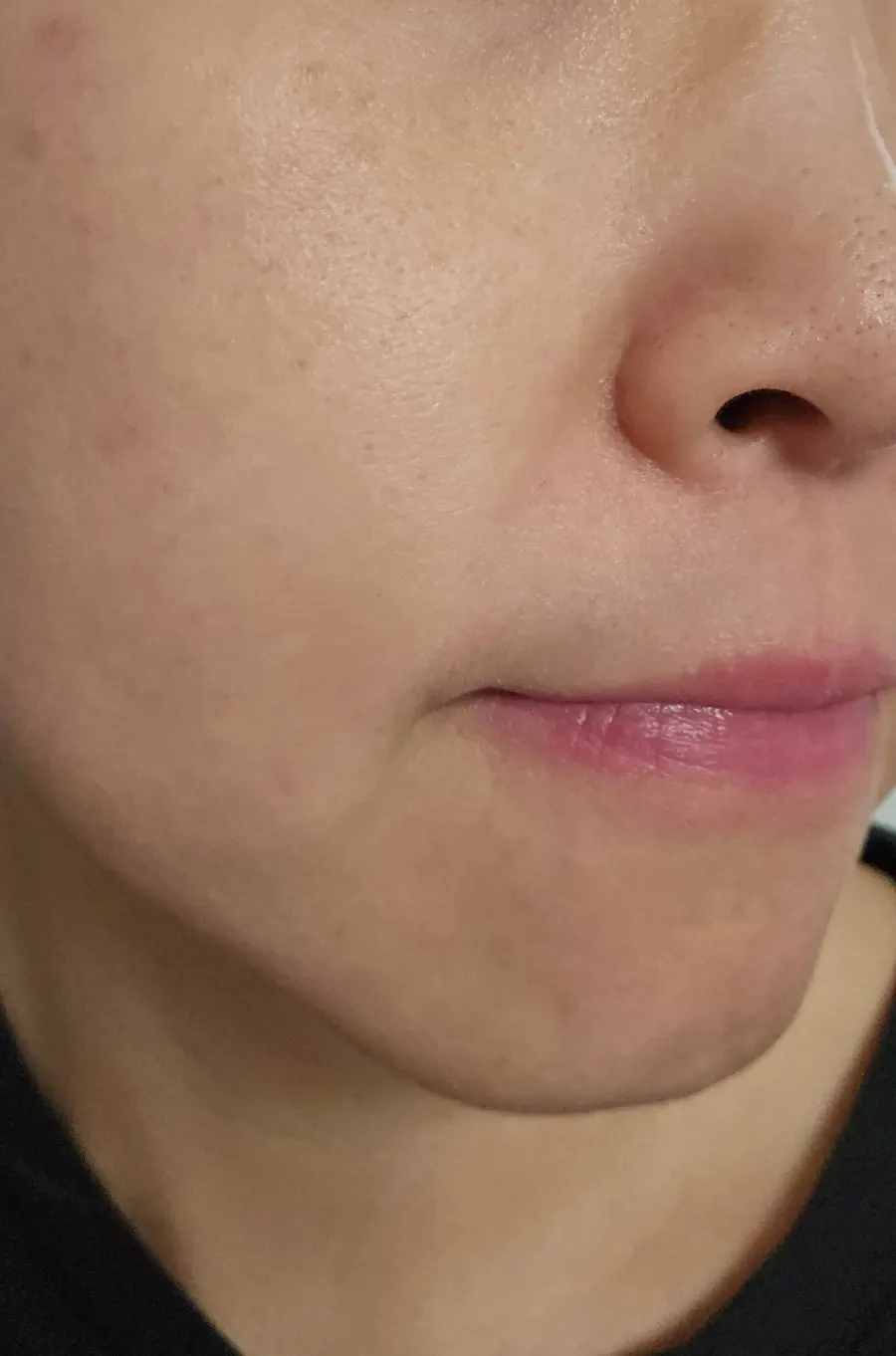 캡슐크림 사용 뒤 촉촉한 피부 모습