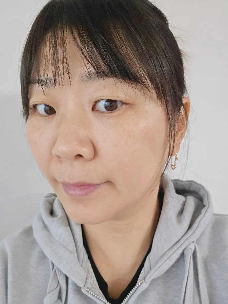 Skin comparison before and after using the cream