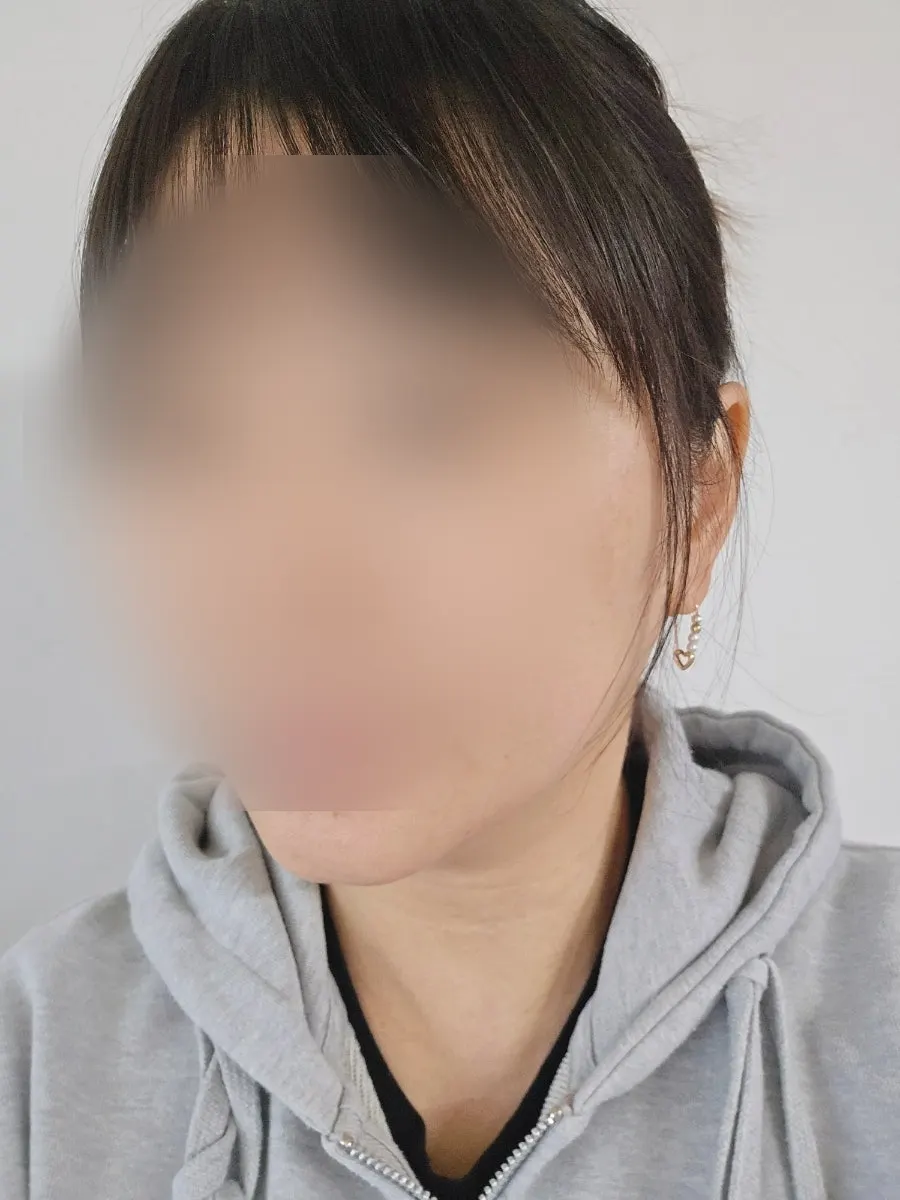 クリーム使用前後の肌比較