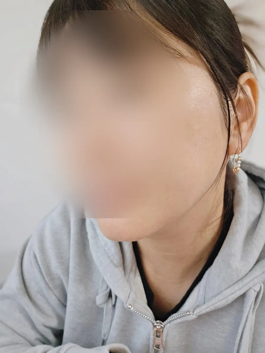 唇まわりの肌の使用前後