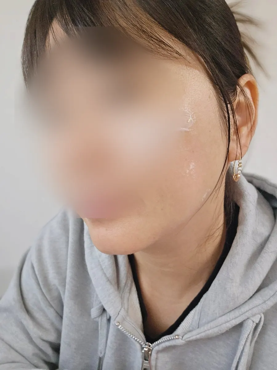 顔の肌にクリームを塗った様子