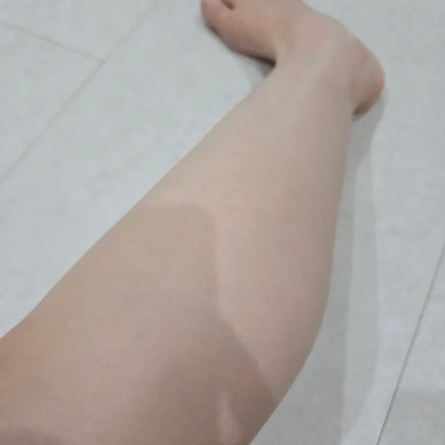 Skin appearance some time after application
