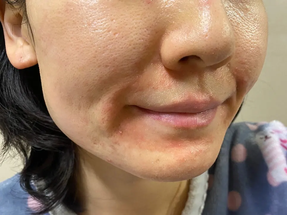 Collagen cream with bouncy moisture