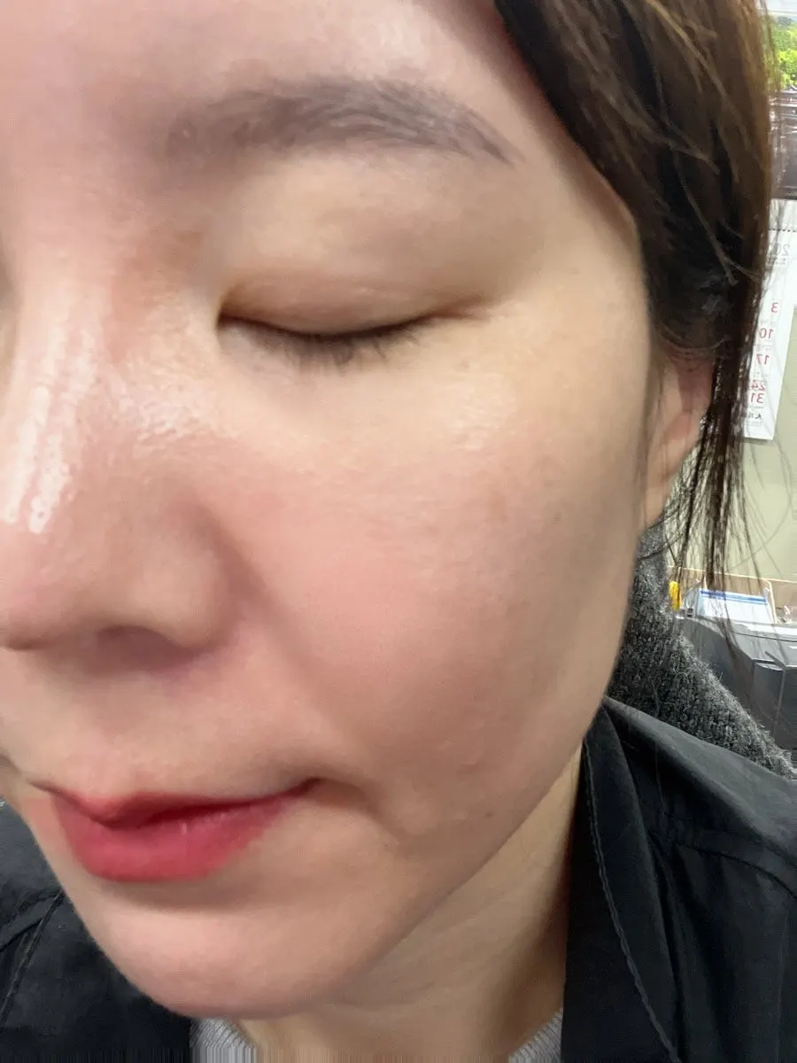 피부에 펴 바른 선스크린 사용 모습