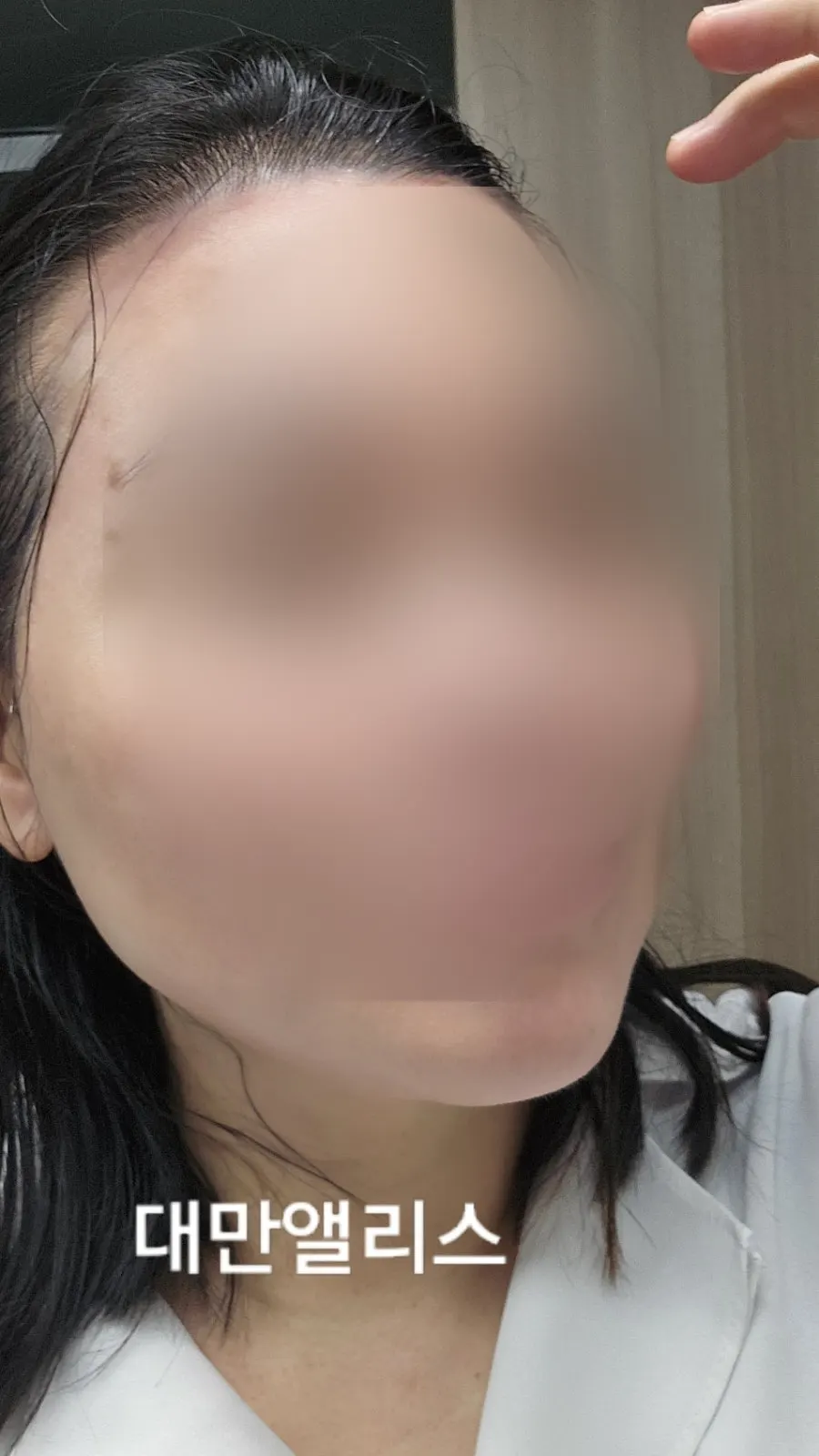백탁 없이 밀착된 선크림 발림 컷