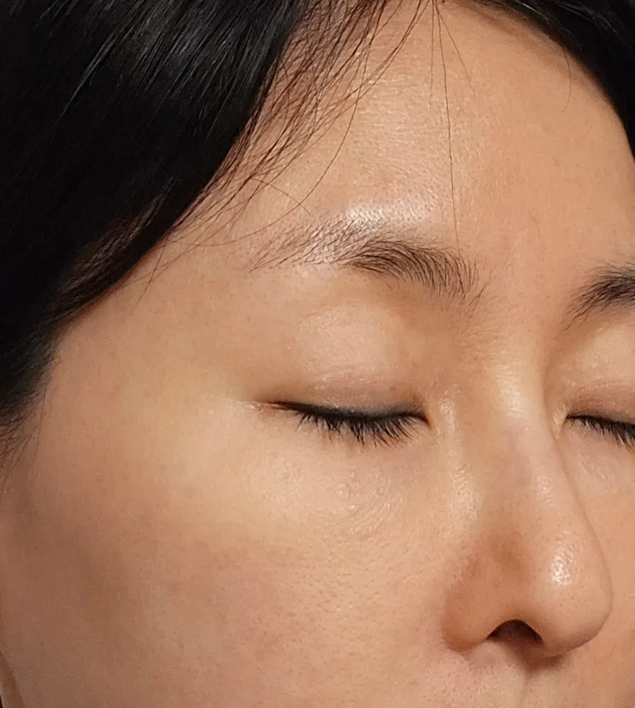 토너와 에센스 사용 후 피부