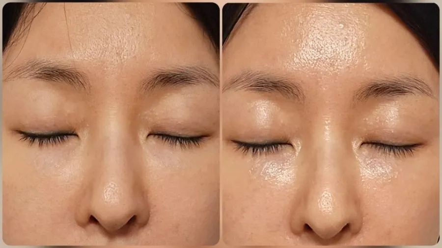 크림 사용 전후 피부 비교