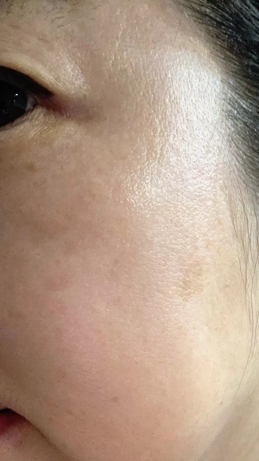 Cheekbone-area skin before and after use