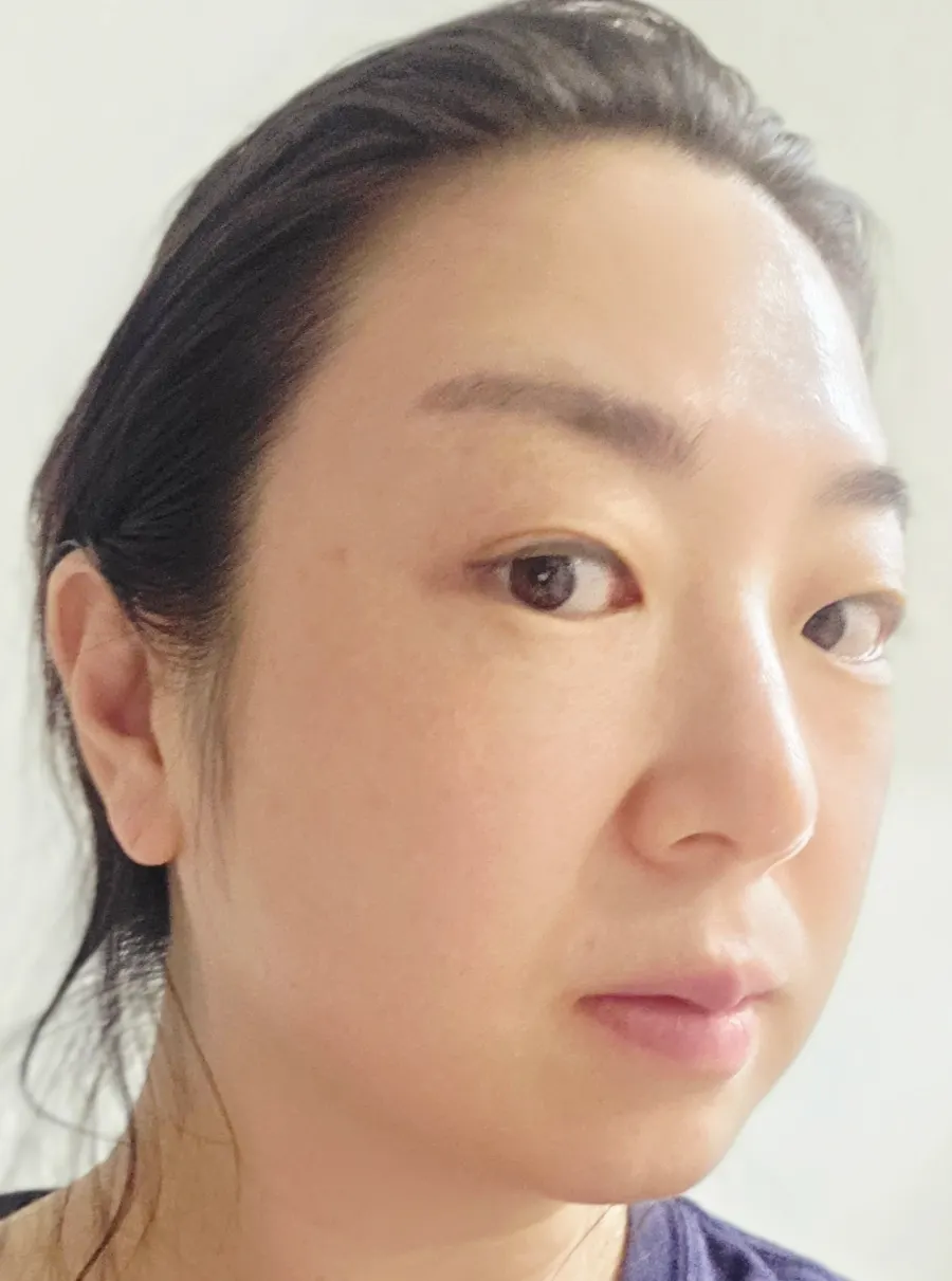 Melabenone ampoule usage guide