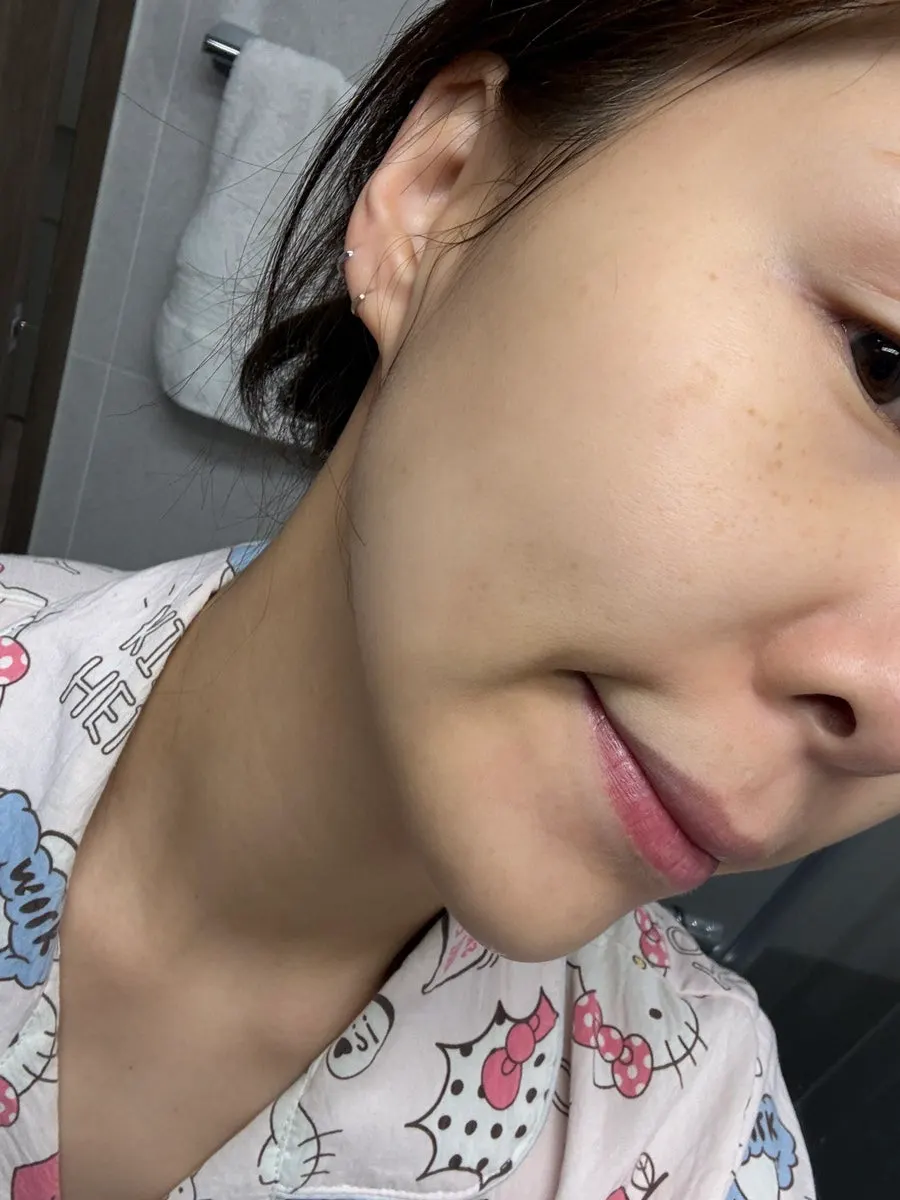 Skin texture after using the mask