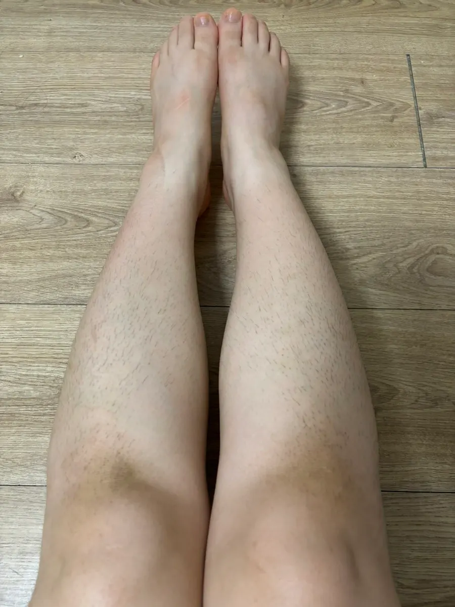 Leg skin before applying the depilatory cream