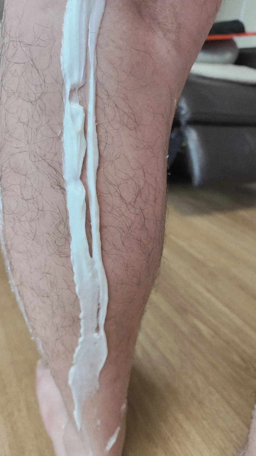 Preparing to apply cream to the area