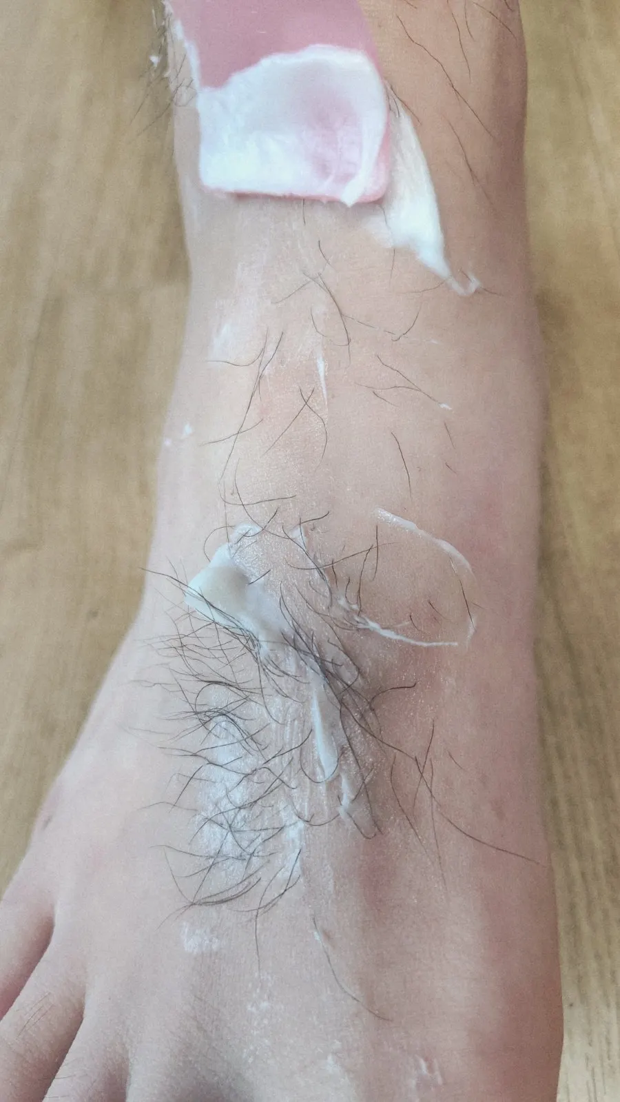 MEDIPICKME hair removal cream after use