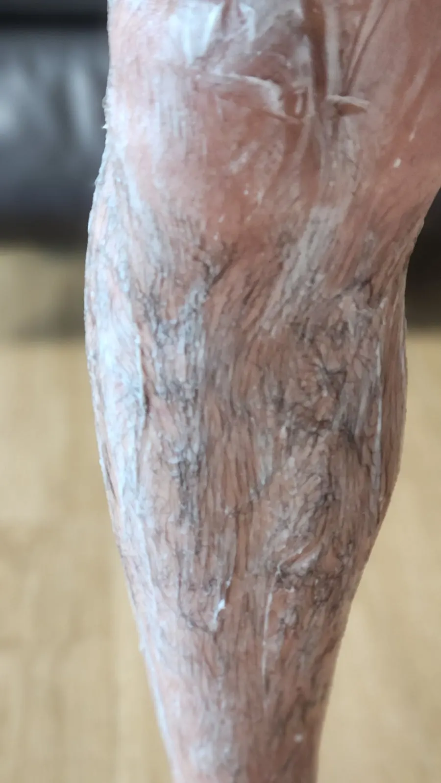Final product shot of MEDIPICKME Touch Up Removal Cream