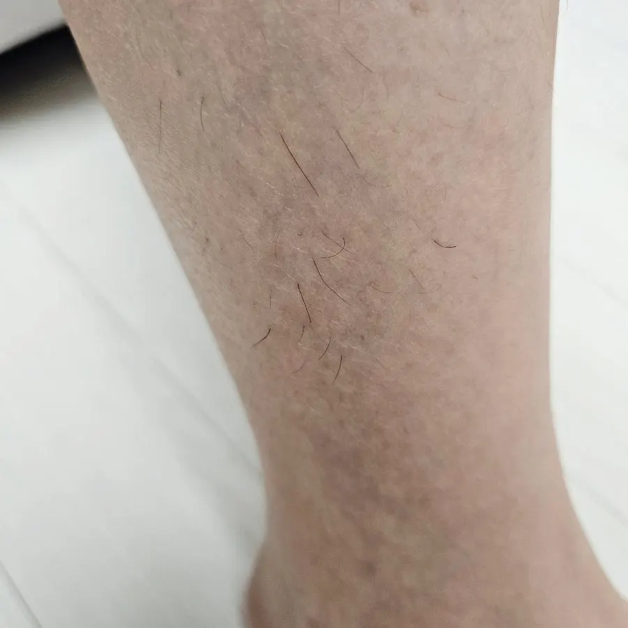 Instructions for using MEDIPICKME hair removal cream