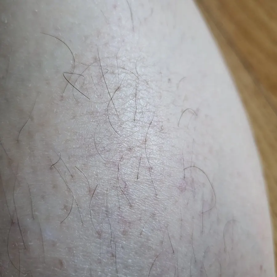 Calf with fine hair before using the hair removal cream