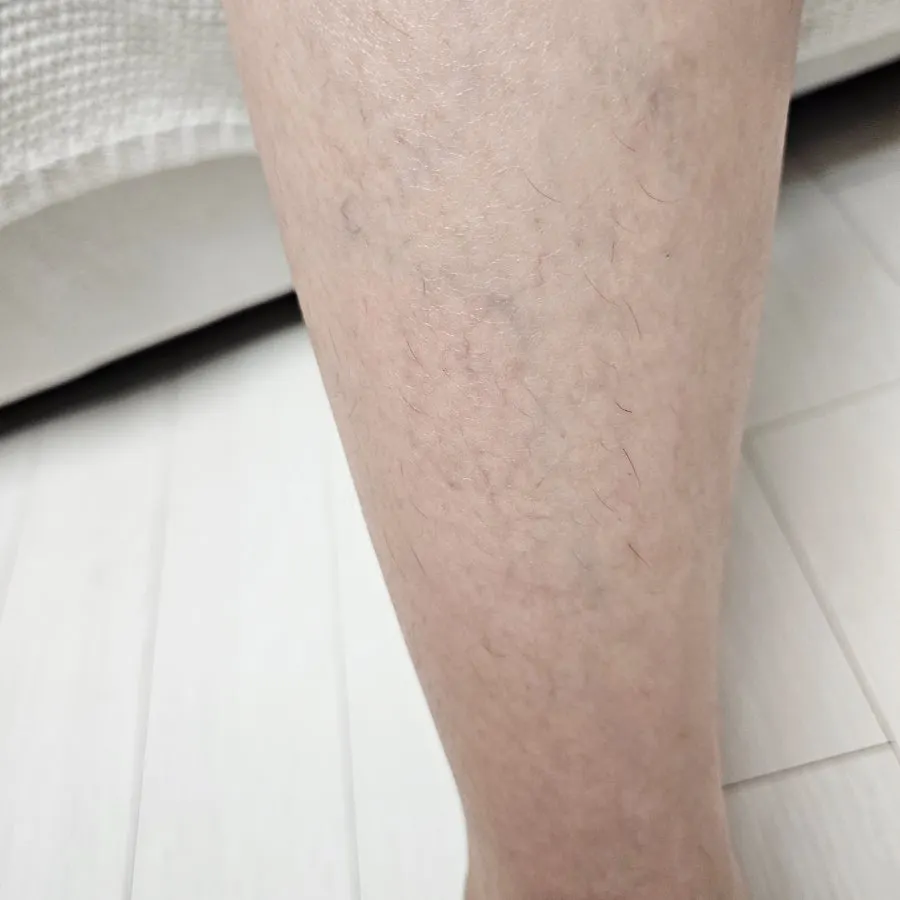 Process of applying the hair removal cream