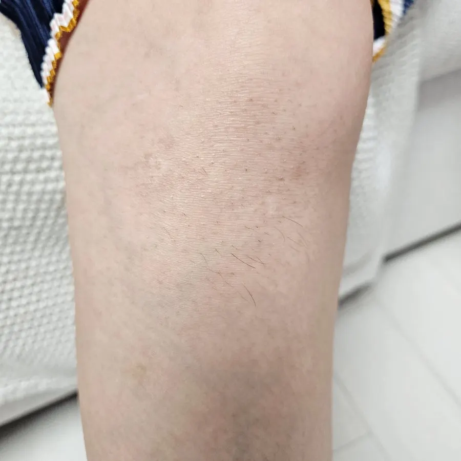 Steps for using the self hair removal cream