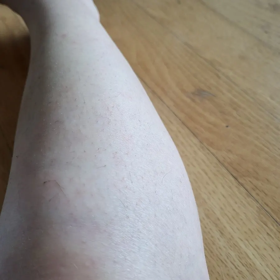 Legs looking tidy after hair removal