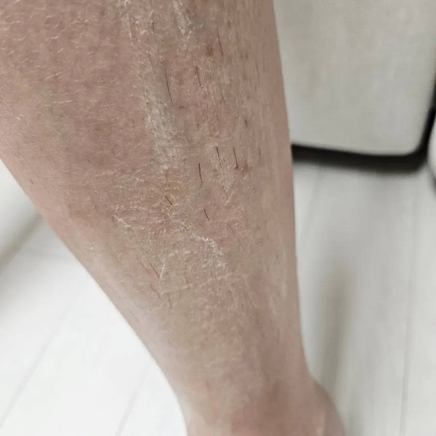 Waiting after applying the hair removal cream