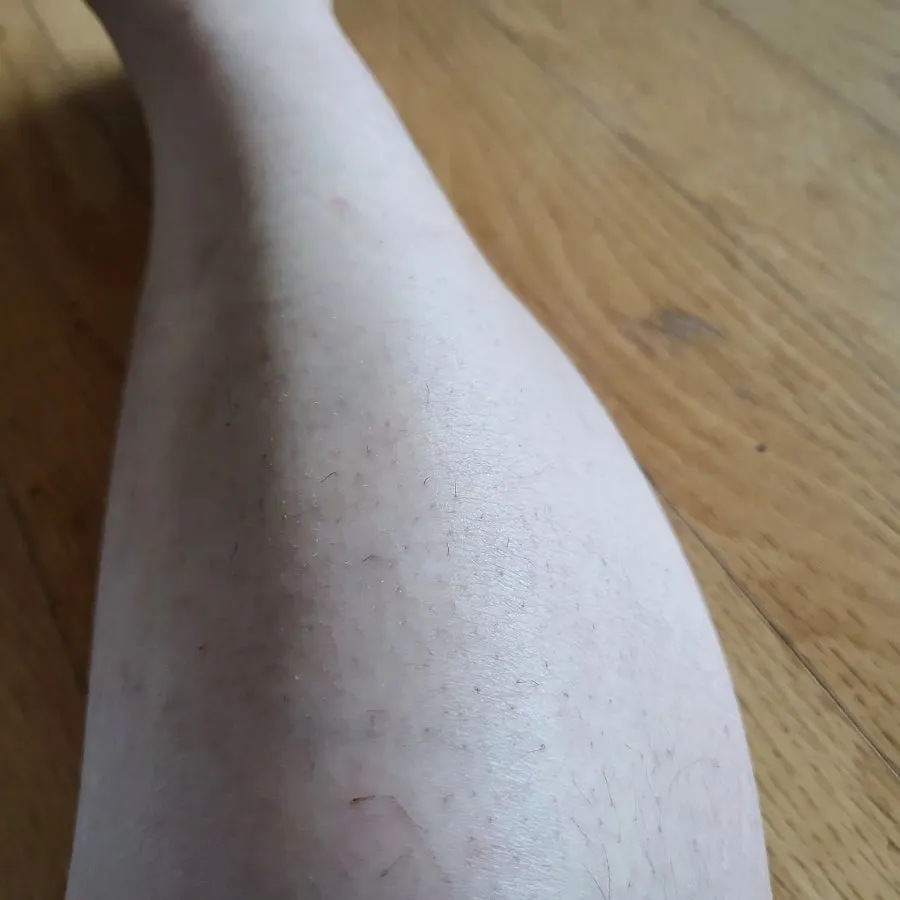 Product shot after using MEDIPICKME Touch-up Removal Cream