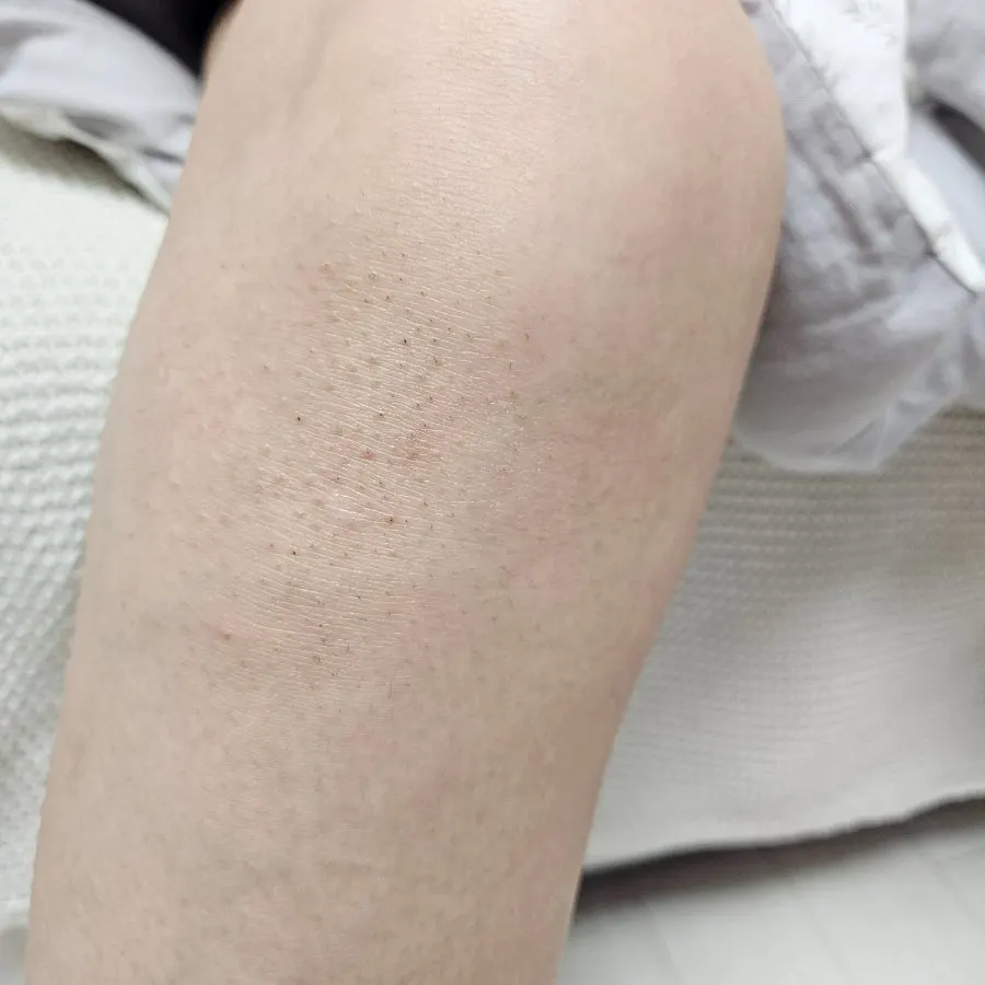 Hair removal cream image introducing skin tone care ingredient