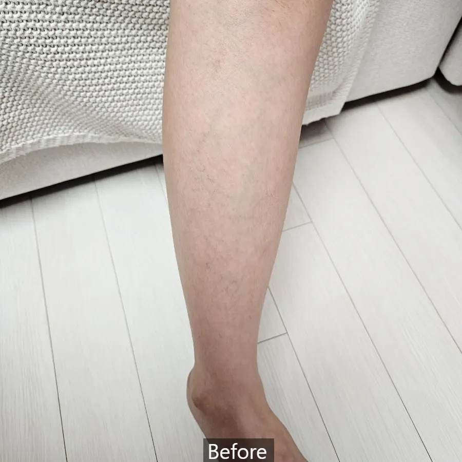 Overall verdict image for MEDIPICKME hair removal cream