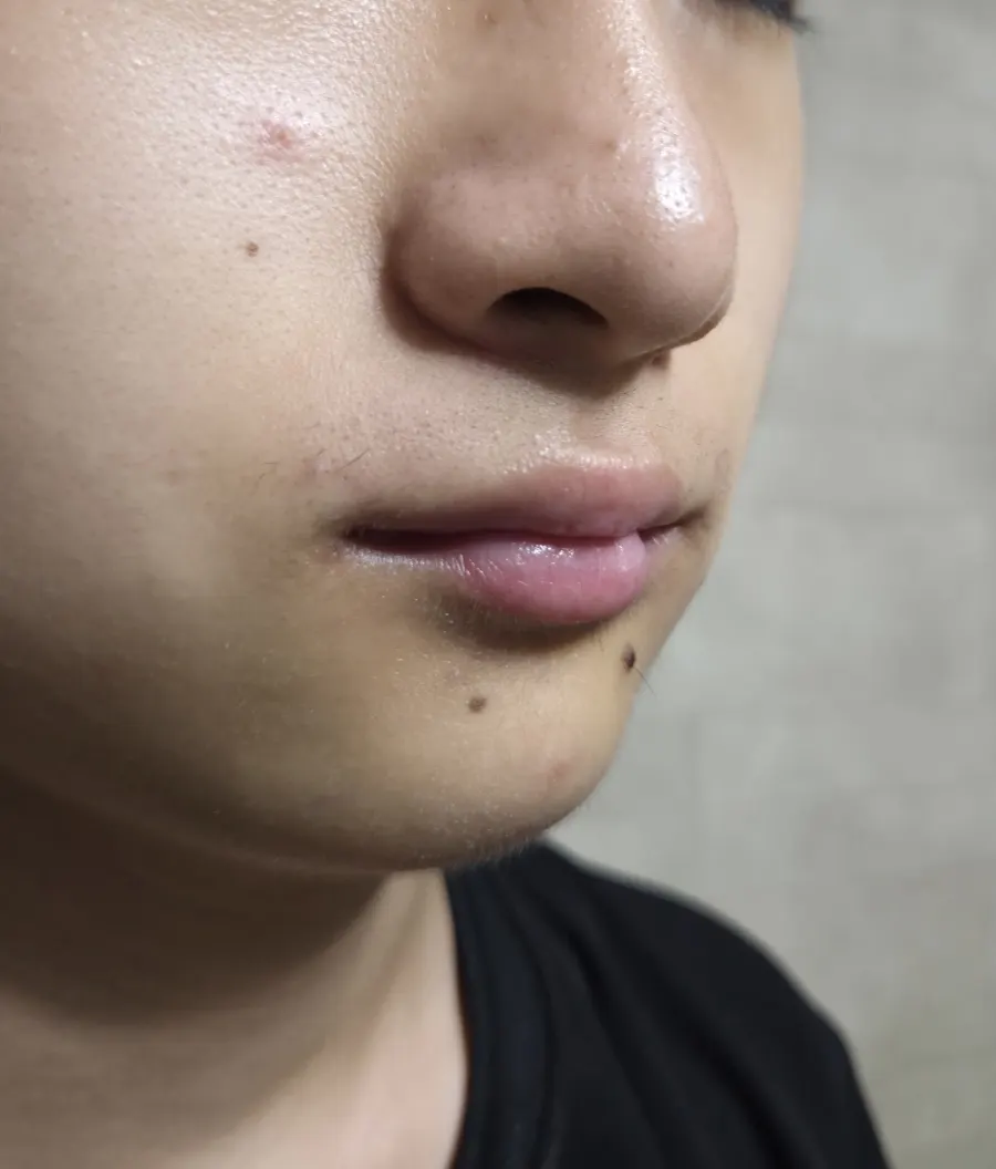 제모 크림을 도포한 모습