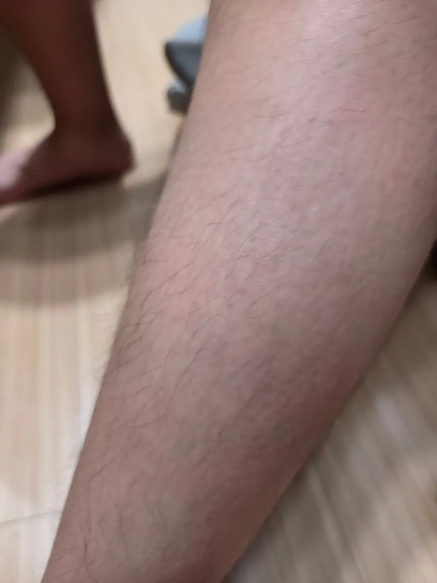 제모 후 피부 톤 관리에 사용하는 크림
