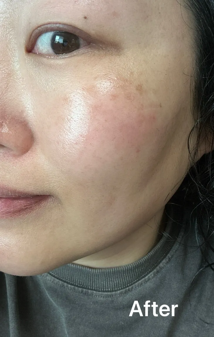 Vertical photo recording skin-tone changes