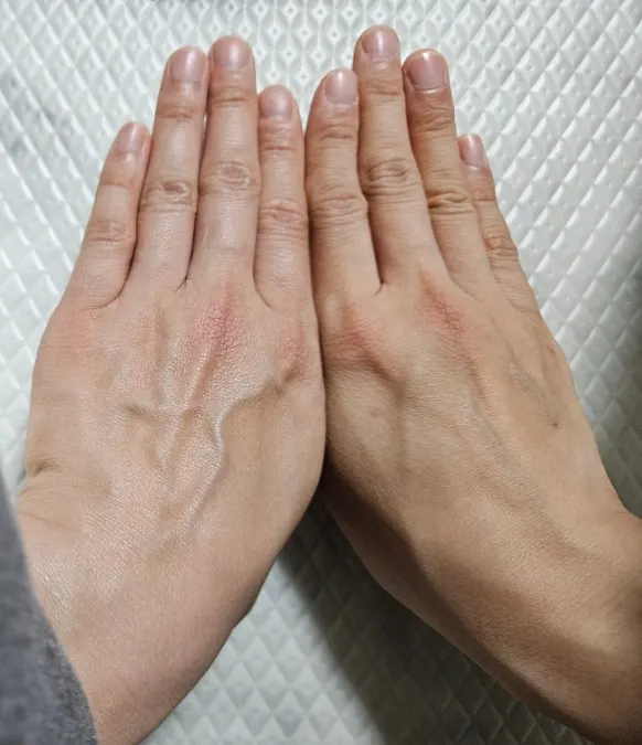 선스크린을 바른 손등의 옅은 톤 변화