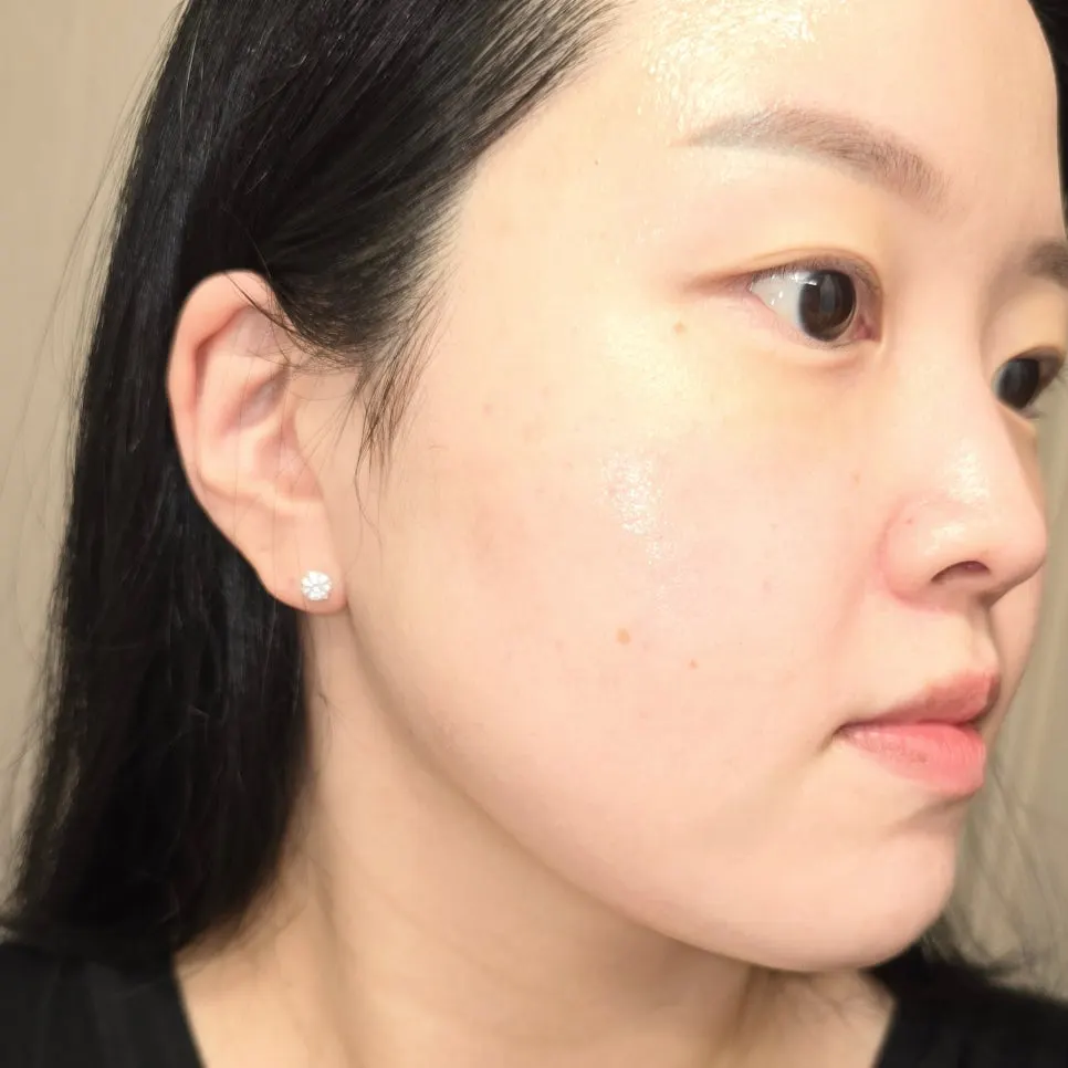 2주 사용 후 피부 상태