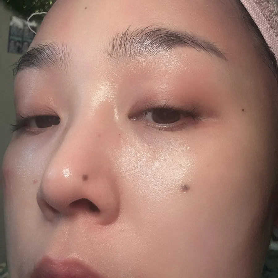 흡수 전 피부 위 비타민 앰플