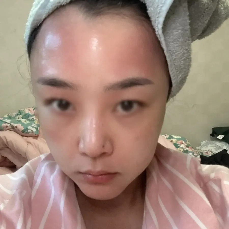 2주 홈케어 뒤 피부 상태 기록
