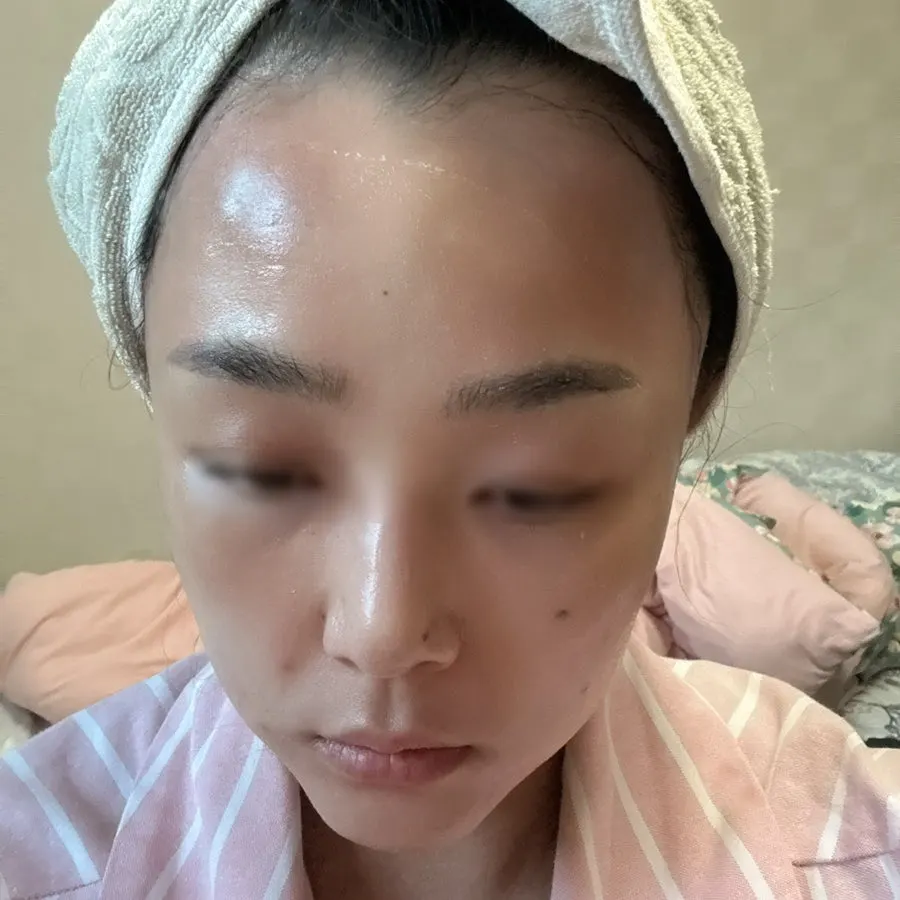 건조한 피부에 사용한 앰플 기록