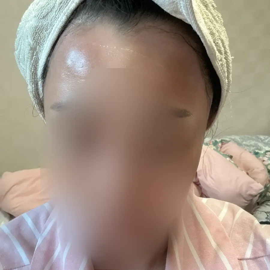 乾燥肌に使用したアンプルの記録