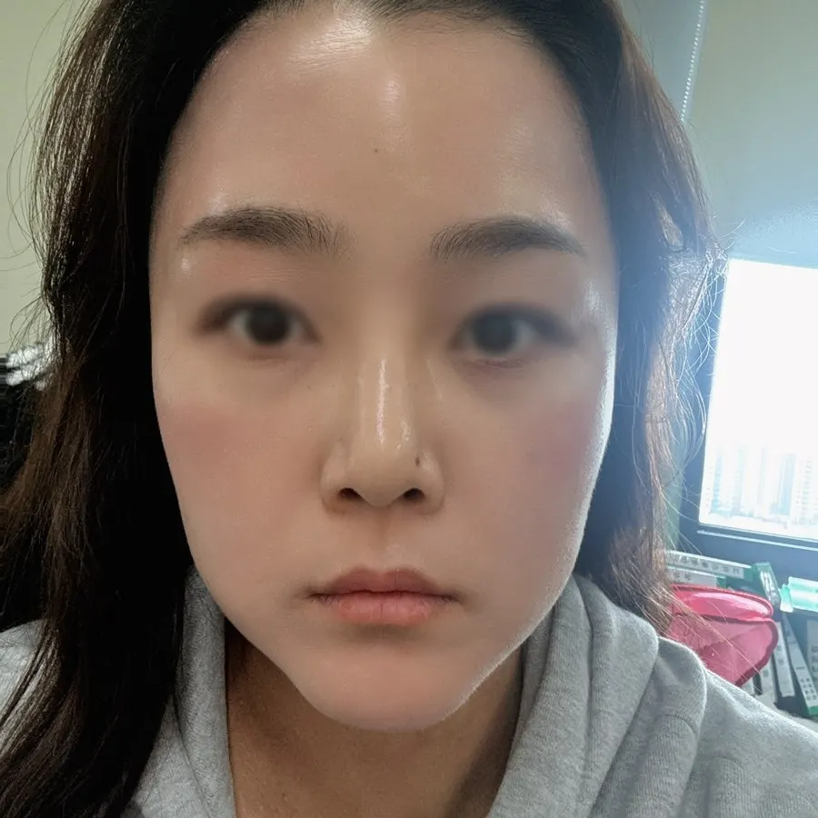 홈케어 비타민 앰플 사용 모습