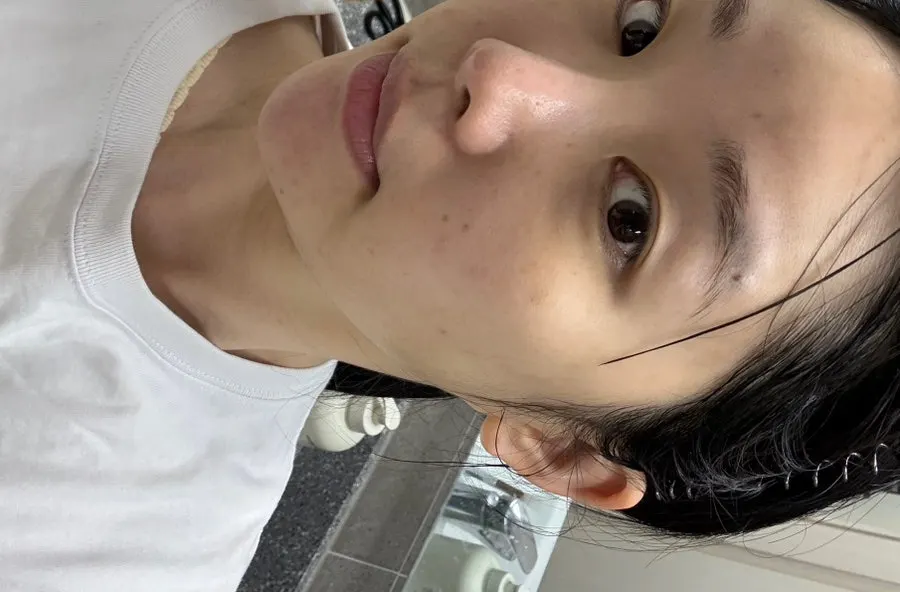 Skin after using the mask