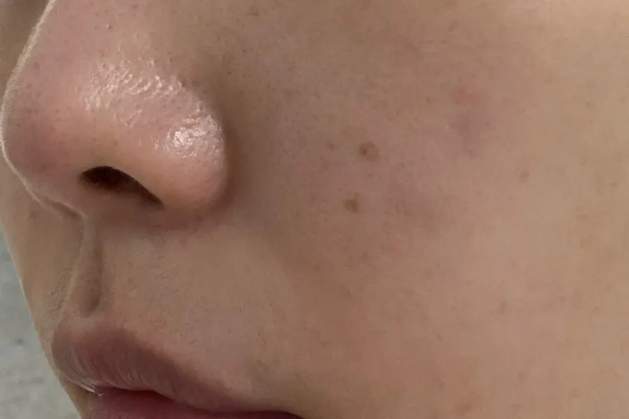 Smooth-looking skin texture after cleansing