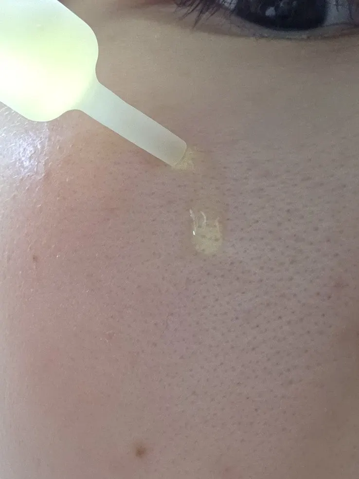 Runny ampoule texture applied to skin